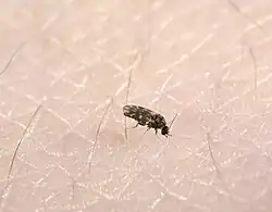 Tiny midge with black-and-white wings on human skin