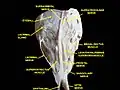 Superior view of a dissection of the orbit. The frontal nerve is visible branching into the supratrochlear and supraorbital nerves.