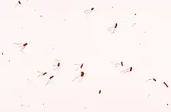 Flagellated "Bordetella bronchiseptica"