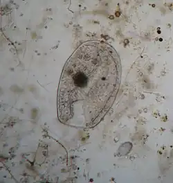 Micrograph of Bursaria ovata, a scoop-shaped ciliate